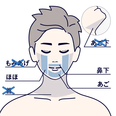 リアラクリニックのヒゲ脱毛の施術範囲