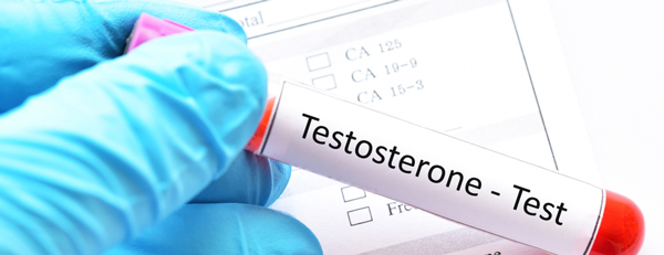 男性ホルモン「テストステロン」がAGAの発端になる？　その仕組みとは　